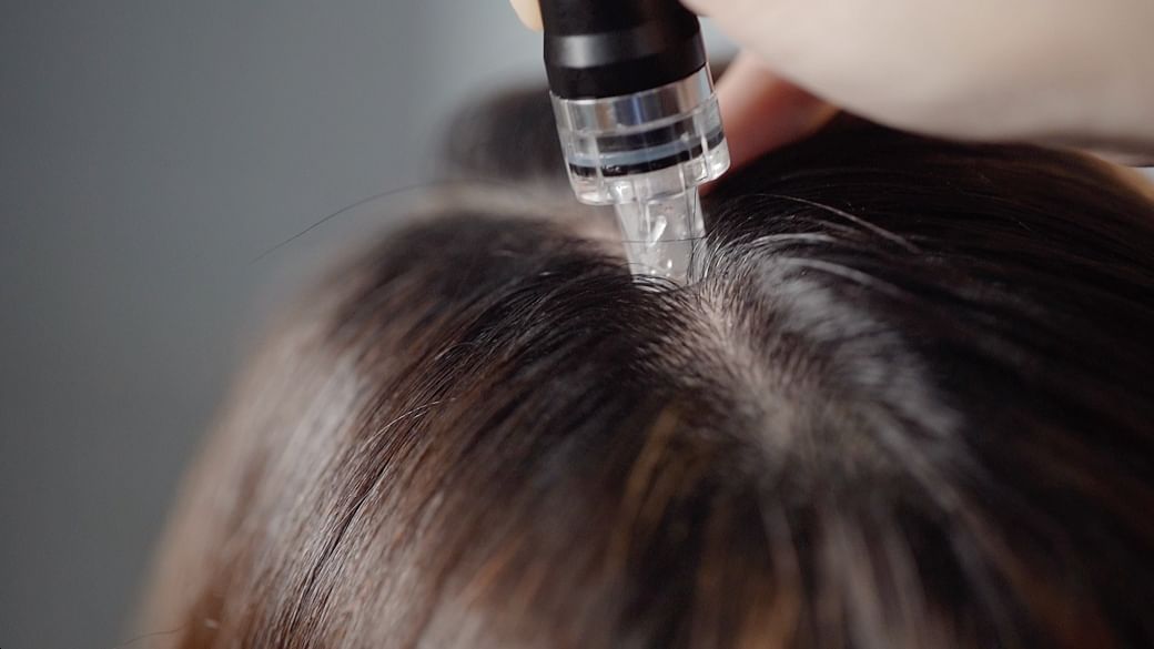 scalp repair treatment